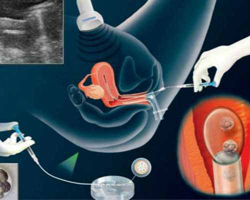深圳为流产的孩子超度方法十分讲究,小说：无数佛家苦修士匍匐在草原之上，